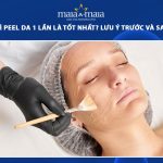 bao lâu thì peel da 1 lần