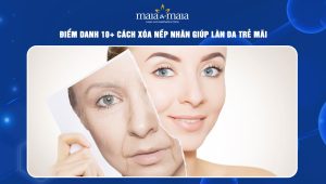 Điểm danh 10+ cách xóa nếp nhăn giúp làn da trẻ mãi 128 cách xóa nếp nhăn