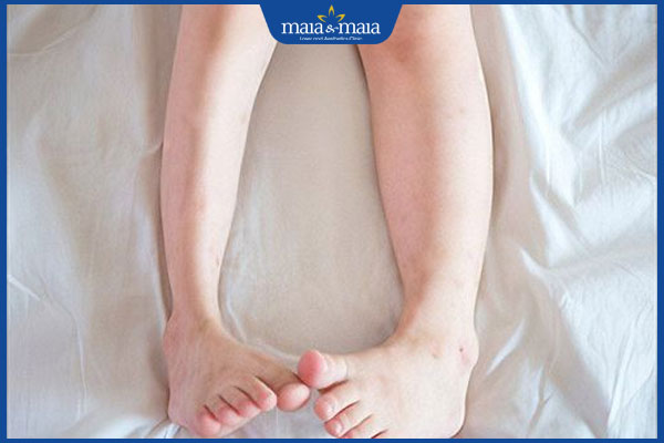 Tiêm botox thon gọn bắp chân: Đối tượng phù hợp, quy trình và chi phí thực hiện  6 chân to chân nhỏ