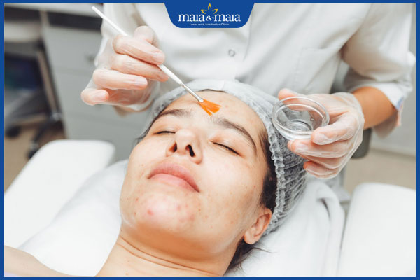 Phương pháp peel da và tẩy tế bào chết khác nhau như thế nào? 2 chi phí peel da