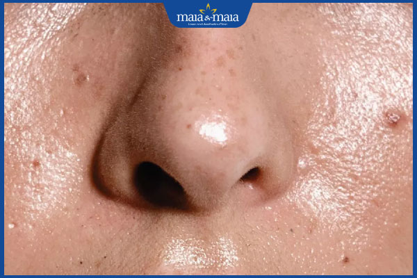 TOP 10 serum chống lão hóa được đánh giá cao hiện nay 3 da đổ dầu