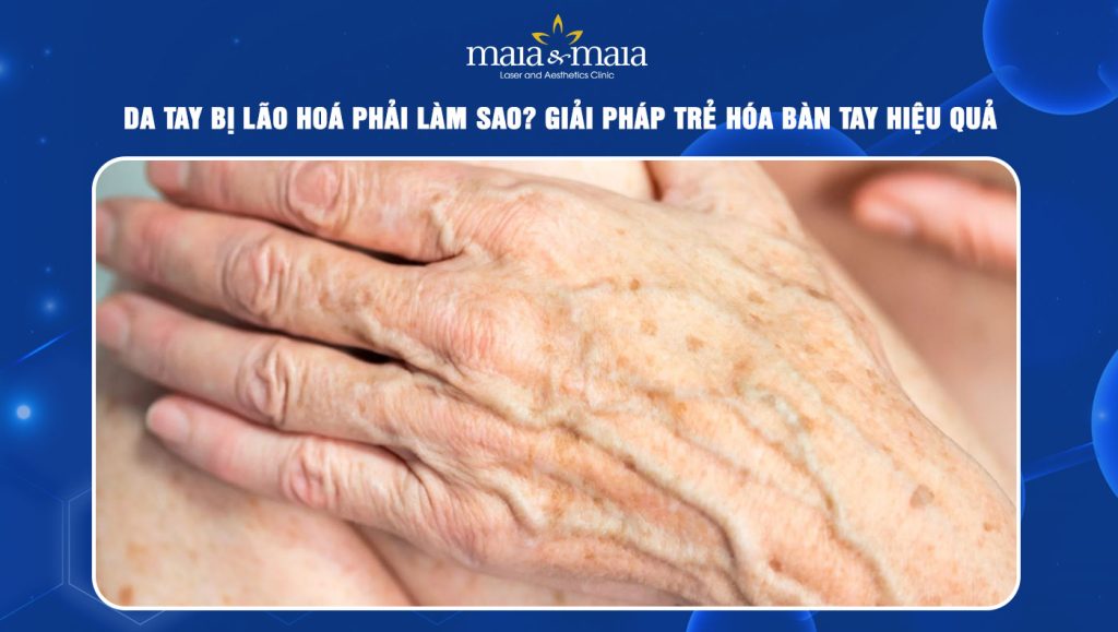 Da tay bị lão hóa