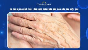 Da tay bị lão hóa phải làm sao? Giải pháp trẻ hóa bàn tay hiệu quả 92 Da tay bị lão hóa