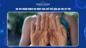 Da tay nhăn nheo do đâu? Địa chỉ trẻ hóa da tay uy tín 55 da tay nhăn nheo