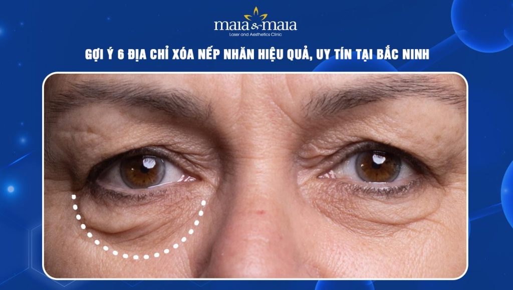 địa chỉ xóa nếp nhăn