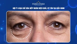 Gợi ý 6 địa chỉ xóa nếp nhăn hiệu quả, uy tín tại Bắc Ninh 46 địa chỉ xóa nếp nhăn