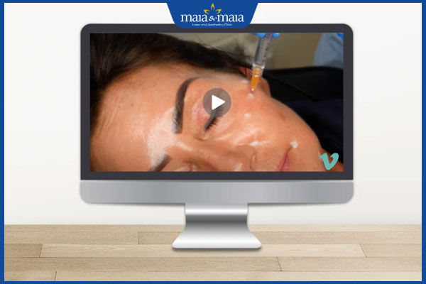 Học tiêm filler online có nên không? Những rủi ro thường gặp  2 học tiêm filler trực tuyến