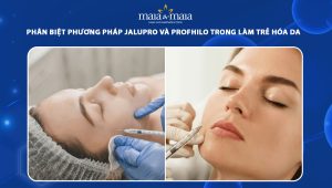 Phân biệt phương pháp jalupro và profhilo trong làm trẻ hóa da 89 jalupro và profhilo