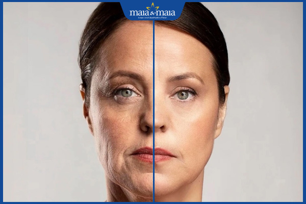 Gợi ý 6 địa chỉ xóa nếp nhăn hiệu quả, uy tín tại Bắc Ninh 2 kết quả xóa nhăn