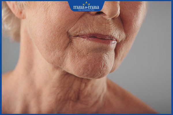 Dấu hiệu lão hóa da - Các phương pháp chăm sóc và cải thiện da chảy xệ  2 làn da bị lão hóa