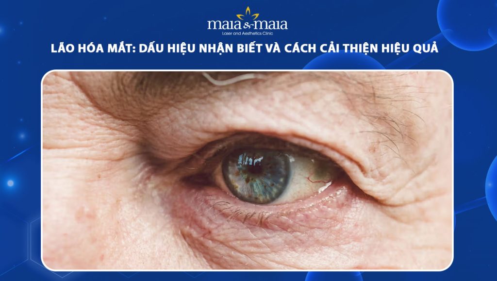 lão hóa mắt