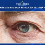 lão hóa mắt