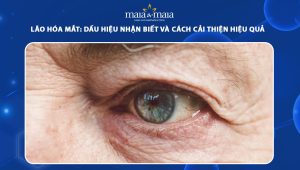 Lão hóa mắt: Dấu hiệu nhận biết và cách cải thiện hiệu quả 40 lão hóa mắt