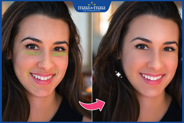 Tổng hợp top 5 app xóa nếp nhăn được ưa chuộng nhất hiện nay! 3 lợi ích khi dùng app xóa nếp nhăn