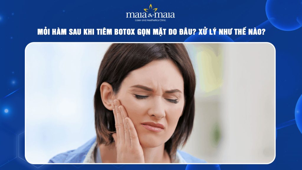 mỏi hàm sau khi tiêm botox gọn mặt