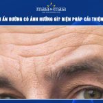 Nếp nhăn ấn đường