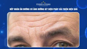 Nếp nhăn ấn đường có ảnh hưởng gì? Biện pháp cải thiện hiệu quả 93 Nếp nhăn ấn đường