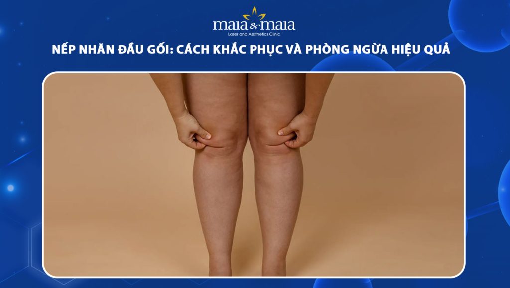 nếp nhăn đầu gối