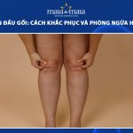 nếp nhăn đầu gối