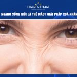 Nếp nhăn ngang sống mũi