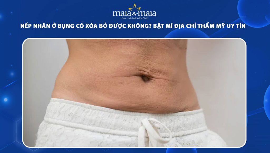 nếp nhăn ở bụng