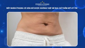 Nếp nhăn ở bụng có xóa bỏ được không? Bật mí địa chỉ thẩm mỹ uy tín hàng đầu  36 nếp nhăn ở bụng