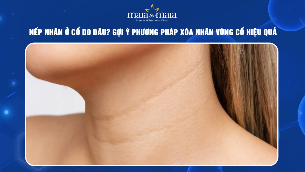 Nếp nhăn ở cổ