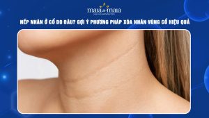 Nếp nhăn ở cổ do đâu? Gợi ý phương pháp xóa nhăn vùng cổ hiệu quả 49 Nếp nhăn ở cổ