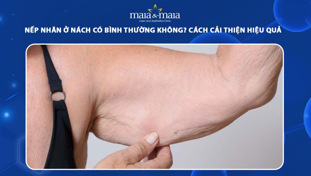 nếp nhăn ở nách