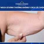 nếp nhăn ở nách