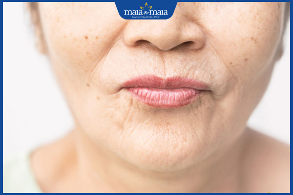 Hướng dẫn chi tiết bài tập giảm nếp nhăn quanh miệng đơn giản, hiệu quả ngay tại nhà 2 nếp nhăn quanh miệng