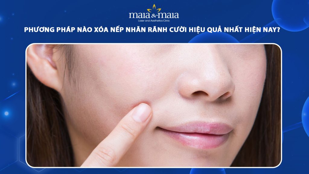 nếp nhăn rãnh cười
