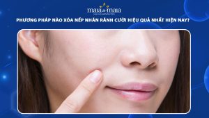Phương pháp nào xóa nếp nhăn rãnh cười hiệu quả nhất hiện nay?  108 nếp nhăn rãnh cười