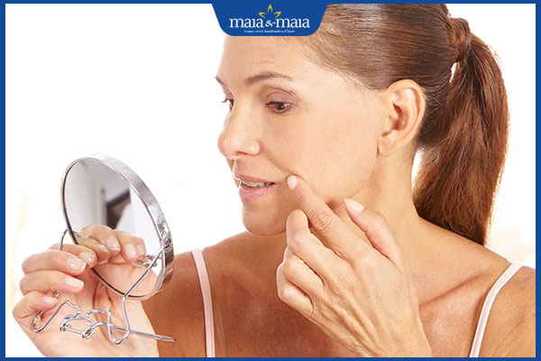 Phương pháp nào xóa nếp nhăn rãnh cười hiệu quả nhất hiện nay?  3 nếp nhăn rãnh cười gây già