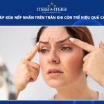nếp nhăn trên trán khi còn trẻ