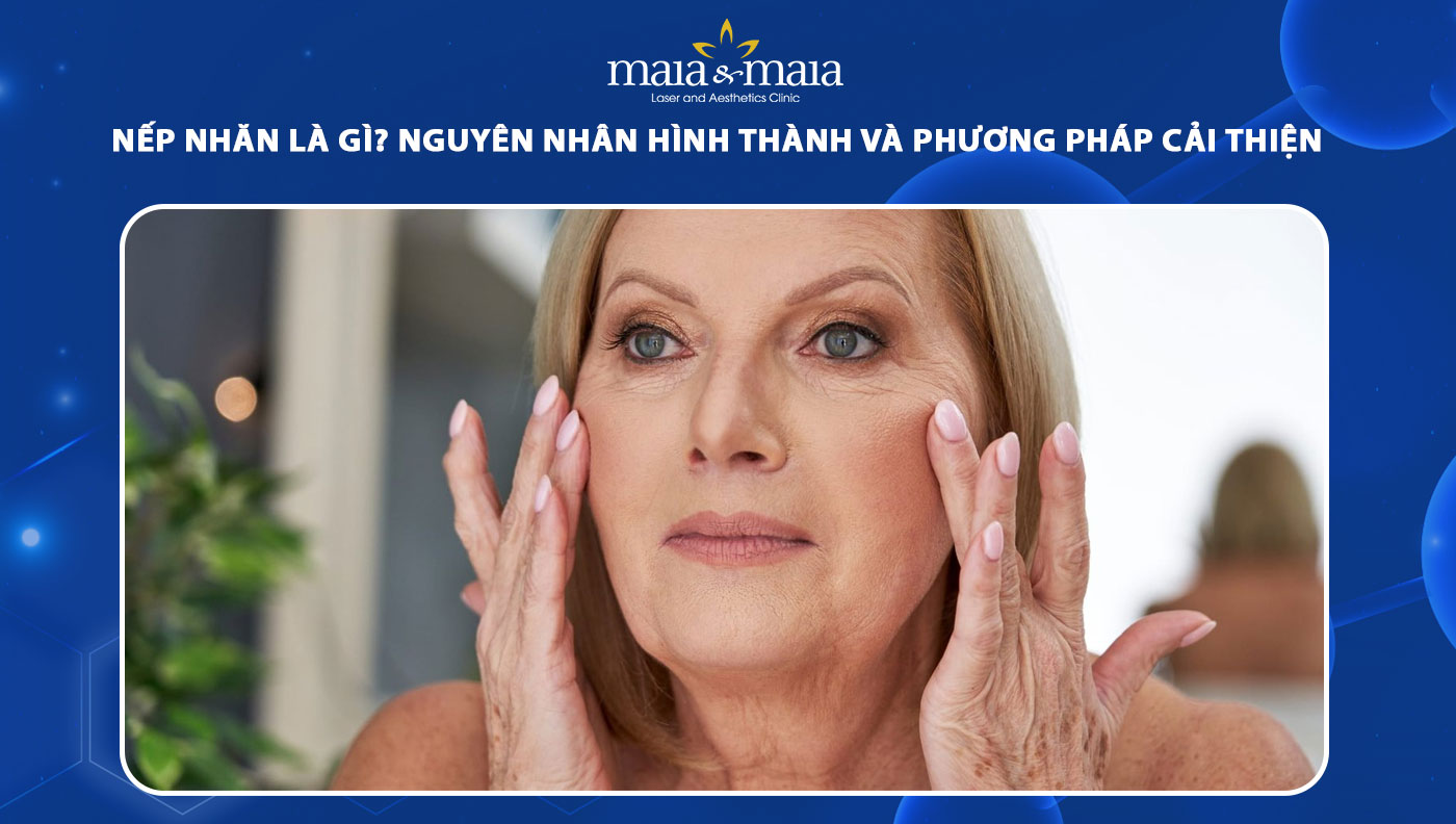 nếp nhăn