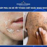 peel da và tẩy tế bào chết