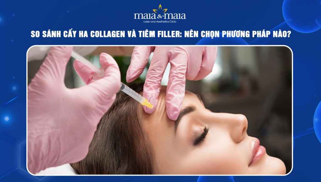 so sánh cấy HA Collagen và tiêm Filler