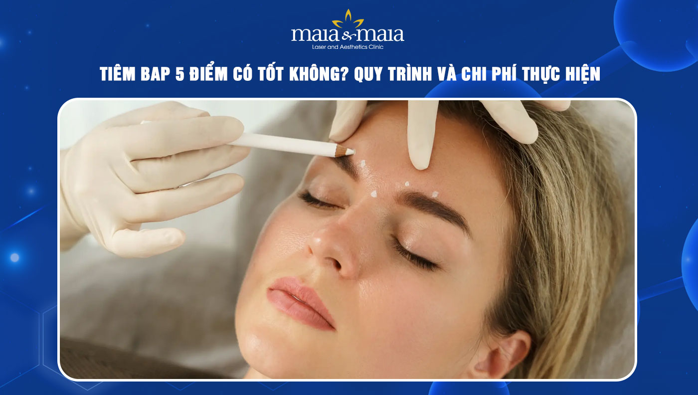 Tiêm BAP 5 điểm