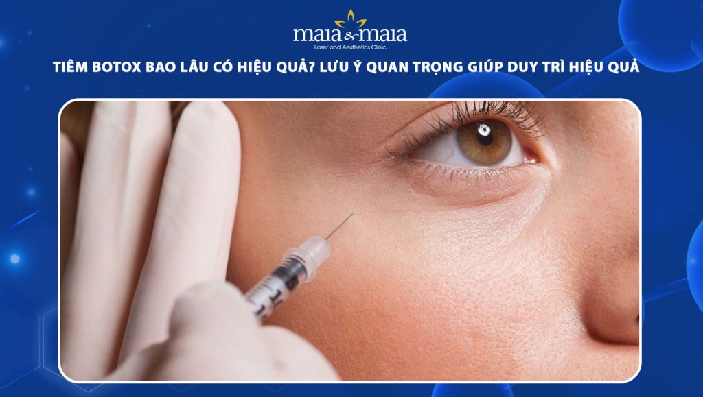 tiêm botox bao lâu có hiệu quả