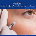 tiêm botox bao lâu có hiệu quả