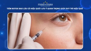 Tiêm botox bao lâu có hiệu quả? Những lưu ý quan trọng giúp duy trì hiệu quả lâu dài khi tiêm botox 79 tiêm botox bao lâu có hiệu quả