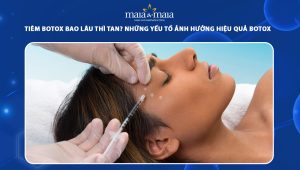 Tiêm botox bao lâu thì tan? Những yếu tố ảnh hưởng hiệu quả botox 76 tiêm botox bao lâu thì tan