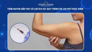 Tiêm botox bắp tay có lợi ích gì? Quy trình và chi phí thực hiện 84 tiêm botox bắp tay