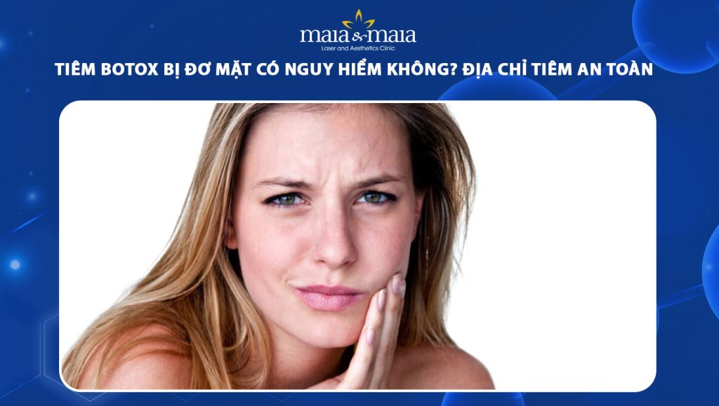 tiêm botox bị đơ mặ
