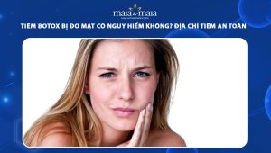 Tiêm botox bị đơ mặt có nguy hiểm không? Địa chỉ tiêm botox an toàn, hiệu quả  97 tiêm botox bị đơ mặ