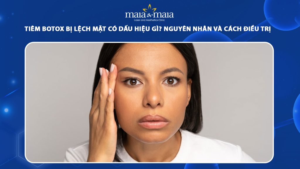 tiêm botox bị lệch mặt