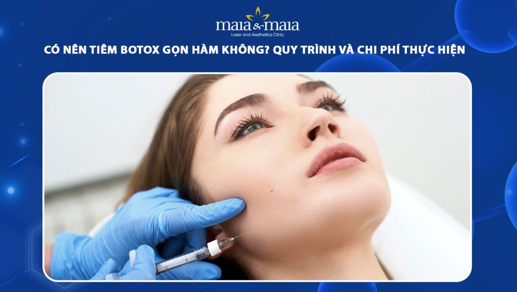 tiêm botox gọn hàm