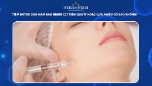 Tiêm botox gọn hàm bao nhiêu cc? Tiêm botox gọn hàm quá ít hoặc quá nhiều có ảnh hưởng gì không? 47 tiêm botox gọn hàm bao nhiêu cc