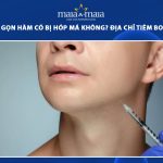 tiêm botox gọn hàm có bị hóp má không